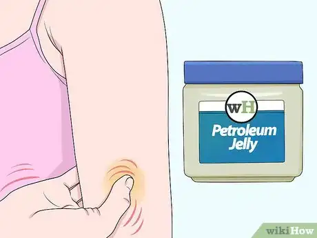 Imagen titulada Get Rid of a Scab Step 6