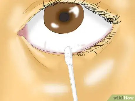 Imagen titulada Get Dirt Out of Your Eye Step 5
