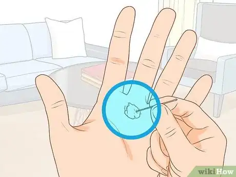 Imagen titulada Treat a Blood Blister Step 12