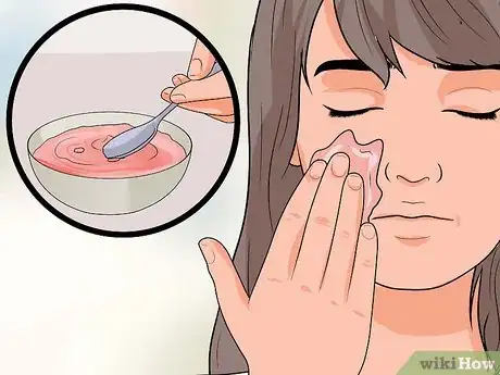 Imagen titulada Get Rid of Acne With Home Remedies Step 16