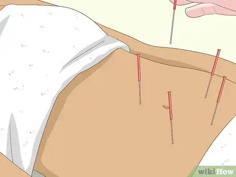 Imagen titulada Shrink Fibroids Naturally Step 14