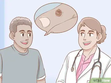 Imagen titulada Identify Warts Step 7