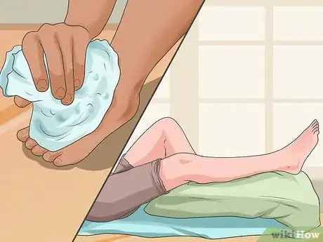 Imagen titulada Tell if a Foot Is Broken Step 10
