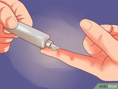Imagen titulada Care for Your Feet and Toenails Step 15