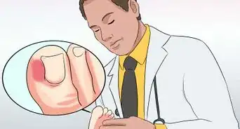 curar una infección en el dedo del pie