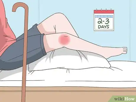 Imagen titulada Heal Ligaments Fast Step 2