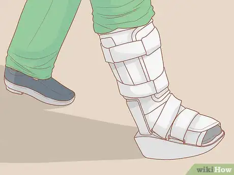 Imagen titulada Walk with a Sprained Ankle Step 4
