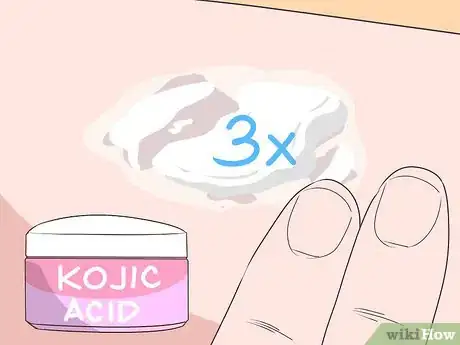 Imagen titulada Lighten Birthmarks Naturally Step 8