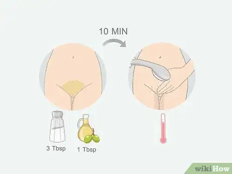 Imagen titulada Get Rid of Ingrown Pubic Hair Step 7