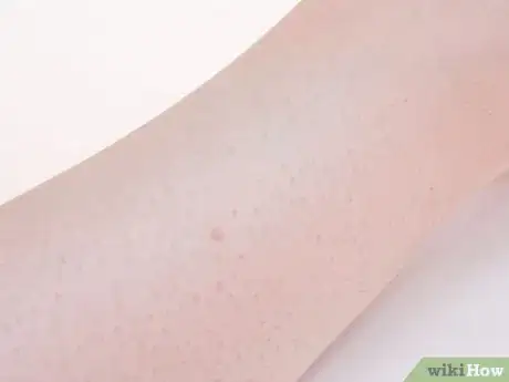 Imagen titulada Prevent Ingrown Hairs on Your Legs Step 14