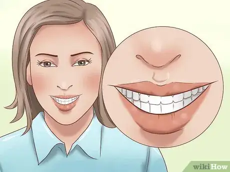 Imagen titulada Have the Perfect Smile Step 5