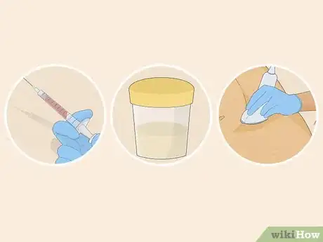 Imagen titulada Tell Eczema from Butterfly Rash Step 6