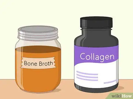 Imagen titulada Heal Your Stomach Lining Step 3