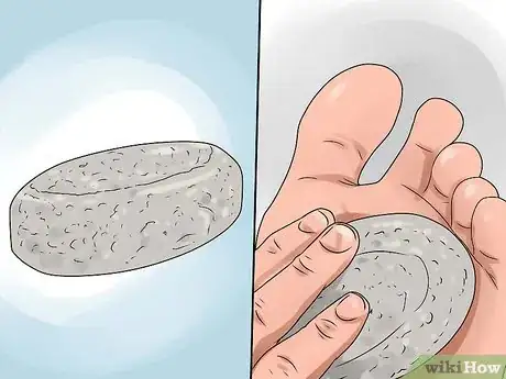 Imagen titulada Treat a Corn or Callus Step 6