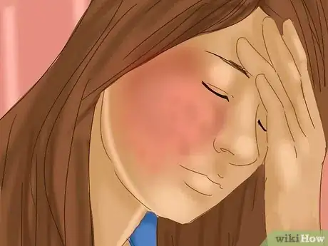 Imagen titulada Get Rid of a Rash on Your Face Step 9