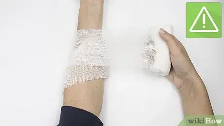 Imagen titulada Strap an Elbow Step 4