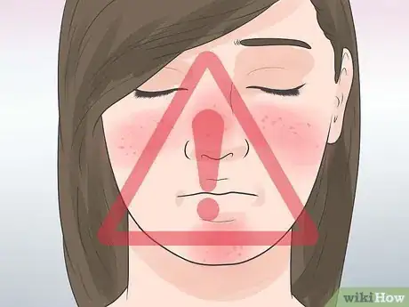 Imagen titulada Recognize an Eyelid Cyst Step 10