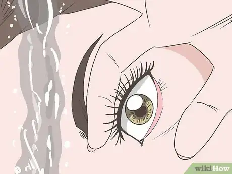 Imagen titulada Stop Watery Eyes Step 1