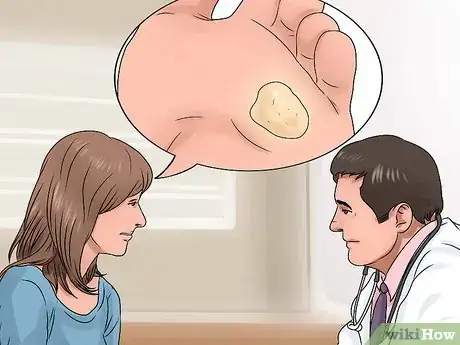 Imagen titulada Treat a Corn or Callus Step 9