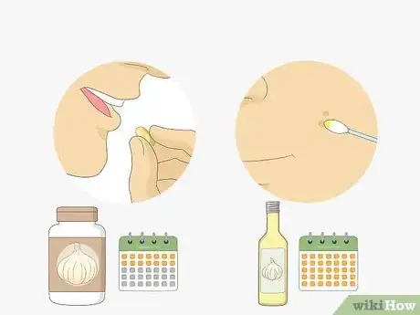 Imagen titulada Get Rid of Warts Step 22