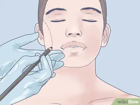 Imagen titulada Make Fake Dimples Step 11