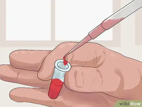 Imagen titulada Differentiate Acute Pancreatitis from Similar Conditions Step 5