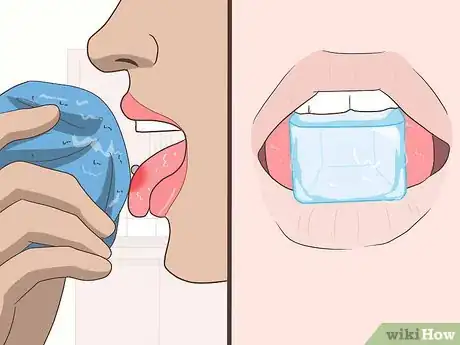 Imagen titulada Reduce Tongue Swelling Step 10