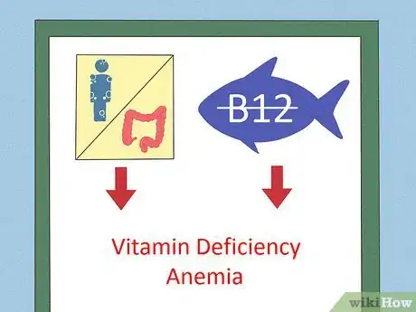Imagen titulada Know if You Are Anemic Step 7