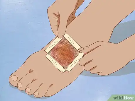 Imagen titulada Apply Different Types of Bandages Step 8