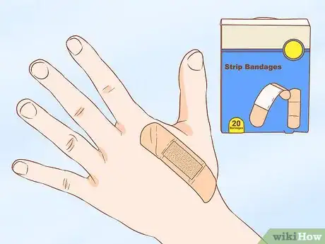 Imagen titulada Apply Different Types of Bandages Step 1