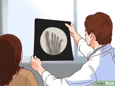 Imagen titulada Treat a Broken Pinky Toe Step 9