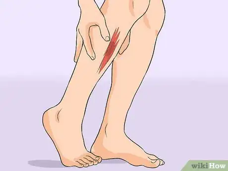 Imagen titulada Treat Cellulitis Step 1