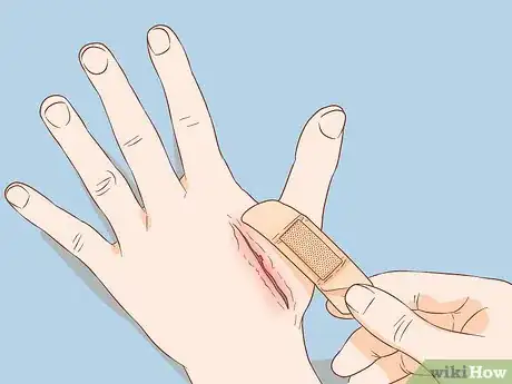 Imagen titulada Apply Different Types of Bandages Step 4