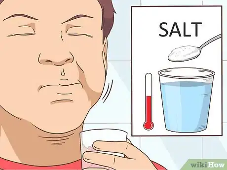 Imagen titulada Remove a Mouth Ulcer Step 1