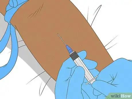 Imagen titulada Know if You Are Anemic Step 5