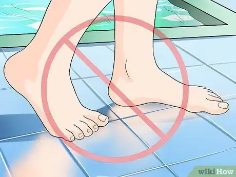 Imagen titulada Get Rid of Foot Fungus Step 1
