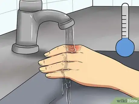 Imagen titulada Treat Minor Burns Step 5