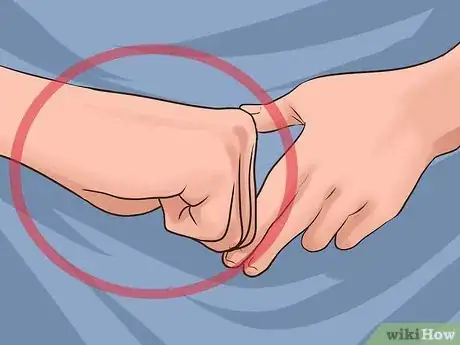 Imagen titulada Perform a Tracheotomy Step 5