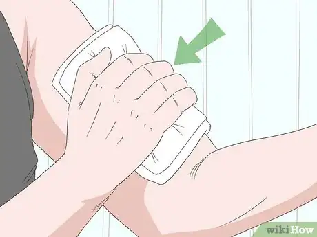 Imagen titulada Remove Glass from a Wound Step 5