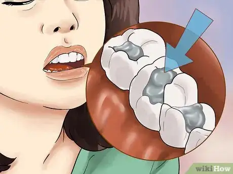 Imagen titulada Heal Mouth Inflammation Step 14