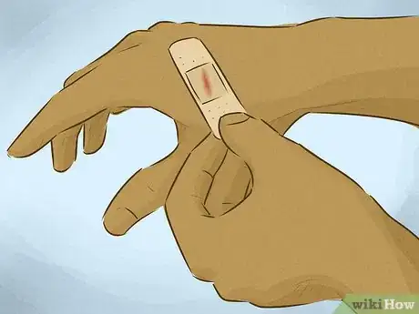 Imagen titulada Stop Bleeding Step 14