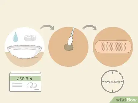 Imagen titulada Get Rid of Warts Step 17