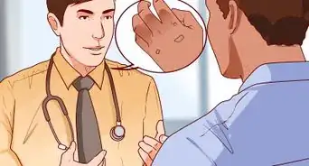 eliminar las verrugas de forma natural con ajo