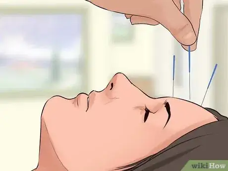 Imagen titulada Alleviate Pain Caused by Trigeminal Neuralgia Step 6