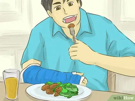 Imagen titulada Have Fun With a Broken Arm Step 16
