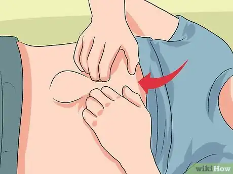 Imagen titulada Push a Hernia Back in Step 3