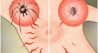 identificar una picadura de araña