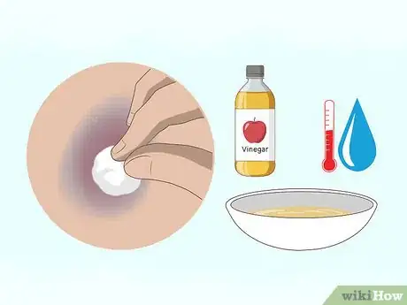 Imagen titulada Make a Bruise Go Away Faster Step 7