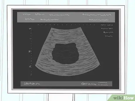 Imagen titulada Prepare for a Pelvic Ultrasound Step 11