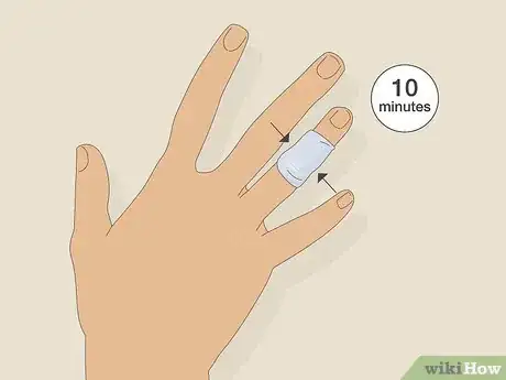 Imagen titulada Deal With the Pain of a Door Being Shut on Your Finger Step 8